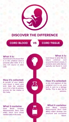 Cord Blood Vs Cord Tissue thumbnail